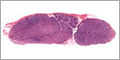 Chapter 10 - Lymphoid System