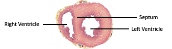 Ventricle Anatomy